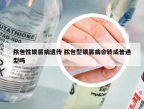 脓包性银屑病遗传 脓包型银屑病会转成普通型吗