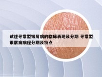 试述寻常型银屑病的临床表现及分期 寻常型银屑病病程分期及特点