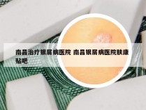 南昌治疗银屑病医院 南昌银屑病医院肤康 贴吧
