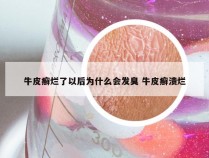 牛皮癣烂了以后为什么会发臭 牛皮癣溃烂