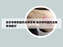 南京有哪些医院治银屑病 南京哪所医院治银屑病最好