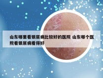 山东哪里看银屑病比较好的医院 山东哪个医院看银屑病看得好