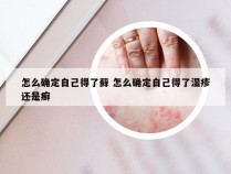 怎么确定自己得了藓 怎么确定自己得了湿疹还是癣