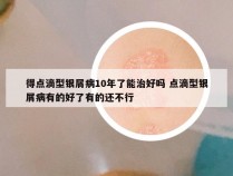 得点滴型银屑病10年了能治好吗 点滴型银屑病有的好了有的还不行