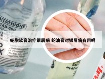 蛇脂软膏治疗银屑病 蛇油膏对银屑病有用吗