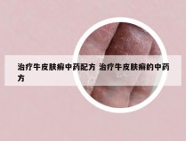 治疗牛皮肤癣中药配方 治疗牛皮肤癣的中药方