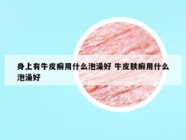 身上有牛皮癣用什么泡澡好 牛皮肤癣用什么泡澡好