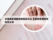 长春银屑病医院就相信华山 长春银屑病研究所怎么样