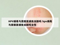HPV病毒与类银屑病有关联吗 hpv病毒与类银屑病有关联吗女性