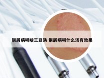 银屑病喝啥三豆汤 银屑病喝什么汤有效果