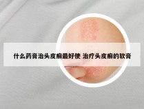 什么药膏治头皮癣最好使 治疗头皮癣的软膏