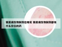 银屑病生物制剂在哪买 银屑病生物制剂都有什么价位的药