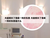 大腿根长了像癣一样的东西 大腿根长了像癣一样的东西是什么