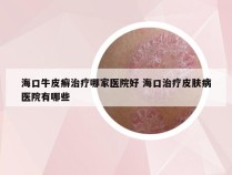 海口牛皮癣治疗哪家医院好 海口治疗皮肤病医院有哪些