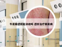牛皮癣透析能决绝吗 透析治疗银屑病