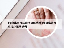 b6维生素可以治疗银屑病吗 b6维生素可以治疗银屑病吗