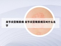 关节炎型银屑病 关节炎型银屑病又叫什么名字