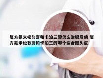 复方氟米松软膏和卡泊三醇怎么治银屑病 复方氟米松软膏和卡泊三醇哪个适合擦头皮