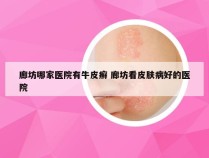 廊坊哪家医院有牛皮癣 廊坊看皮肤病好的医院