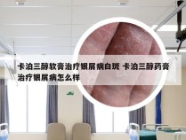 卡泊三醇软膏治疗银屑病白斑 卡泊三醇药膏治疗银屑病怎么样