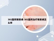 301医院银屑病 301医院治疗银屑病怎么样