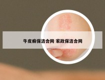 牛皮癣保洁合同 家政保洁合同