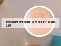 怎样清除电梯牛皮癣广告 电梯上的广告纸怎么撕