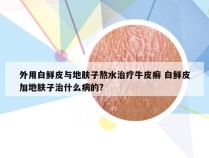 外用白鲜皮与地肤子熬水治疗牛皮癣 白鲜皮加地肤子治什么病的?