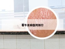 看牛皮癣医院排行