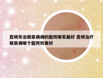 昆明市治银屑病病的医院哪家最好 昆明治疗银屑病哪个医院效果好