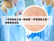 一岁宝宝身上有一块白斑 一岁宝宝身上有一块皮肤有点白