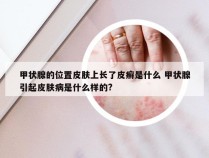 甲状腺的位置皮肤上长了皮癣是什么 甲状腺引起皮肤病是什么样的?