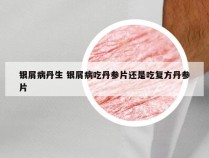 银屑病丹生 银屑病吃丹参片还是吃复方丹参片