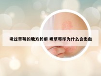 吸过草莓的地方长癣 吸草莓印为什么会出血