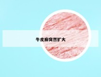 牛皮癣突然扩大