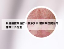银屑病住院治疗一般多少天 银屑病住院治疗都做什么检查