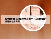 北京协和医院银屑病谁冶最好 北京协和医院银屑病专用药膏