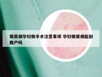 银屑病孕妇做手术注意事项 孕妇银屑病能剖腹产吗
