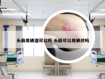 头癣用碘酒可以吗 头藓可以用碘伏吗