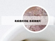 毒癣康的功能 毒癣康图片