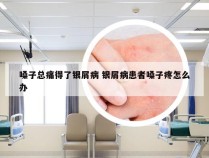 嗓子总痛得了银屑病 银屑病患者嗓子疼怎么办