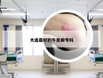 大连最好的牛皮癣专科