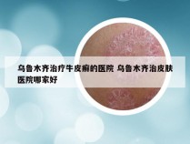 乌鲁木齐治疗牛皮癣的医院 乌鲁木齐治皮肤医院哪家好