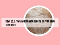 国内已上市的治银屑病生物制剂 国产银屑病生物制剂