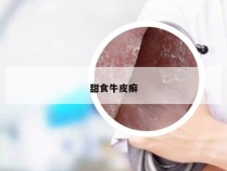 甜食牛皮癣