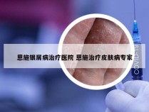 恩施银屑病治疗医院 恩施治疗皮肤病专家
