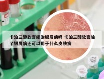 卡泊三醇软膏能治银屑病吗 卡泊三醇软膏除了银屑病还可以用于什么皮肤病
