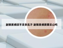 副银屑病该不该多出汗 副银屑病需要忌口吗