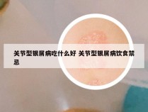 关节型银屑病吃什么好 关节型银屑病饮食禁忌