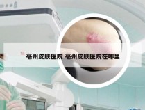 亳州皮肤医院 亳州皮肤医院在哪里